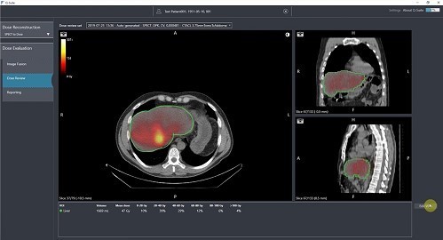 Q-Suite software, developed by Quirem Medical